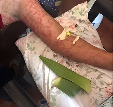 A swarm of bees attacked a group of people, leading to the death of an internally displaced person (IDP) and injuring three others